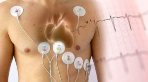 Диагностика сердечно-сосудистой системы